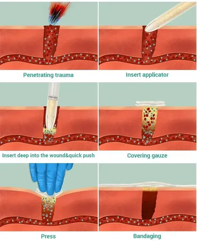 Chitosan Powder Applicator with Hemostatic Granule Bandage for Emergency Use image 1